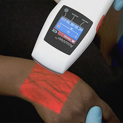 Accuvein supplied by Q Medical Technologies